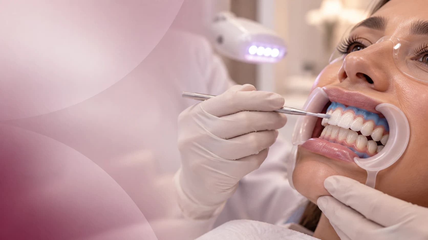 Procedimento clínico de clareamento dental com iluminação odontológica